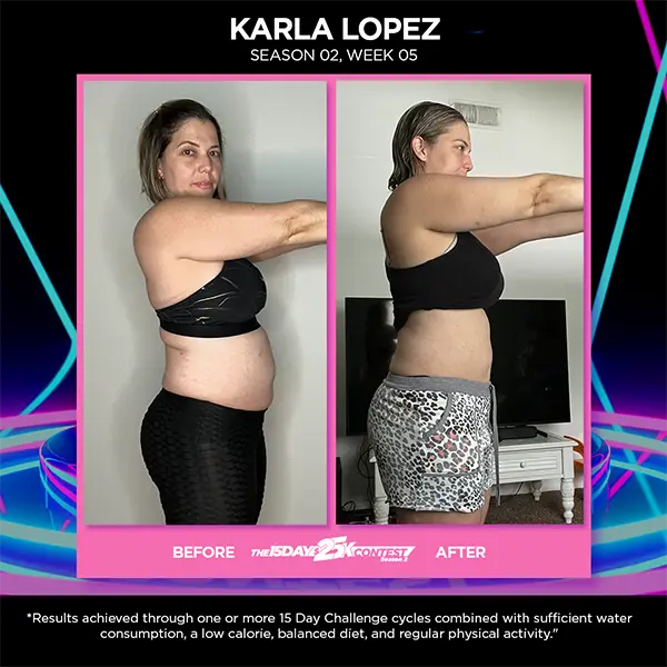 Before After Karla Lopez