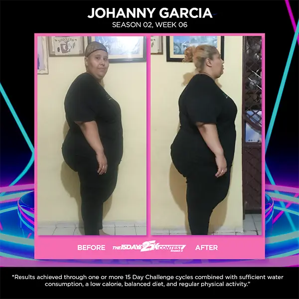 Before After JOHANNY GARCIA